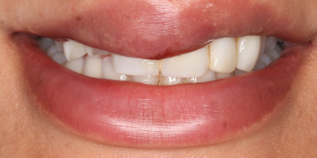 24 Hour Emergency Dentist Manchester | Same Day Appointments