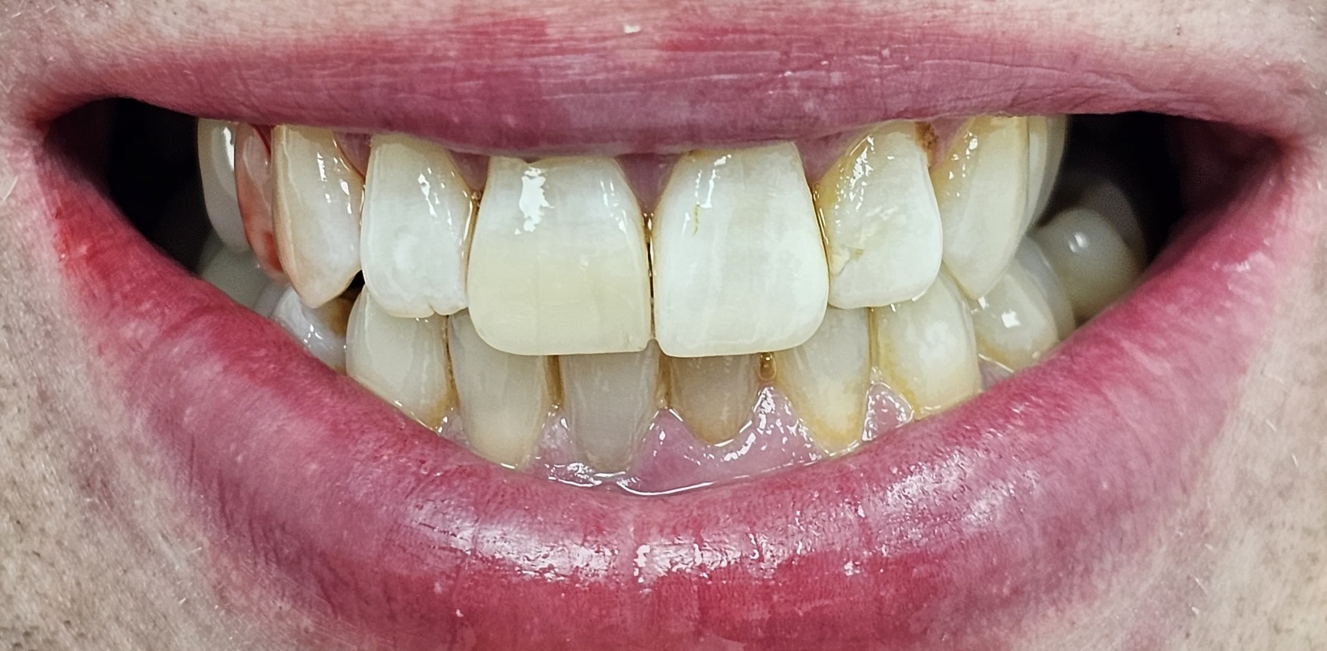 24 Hour Emergency Dentist Manchester | Same Day Appointments