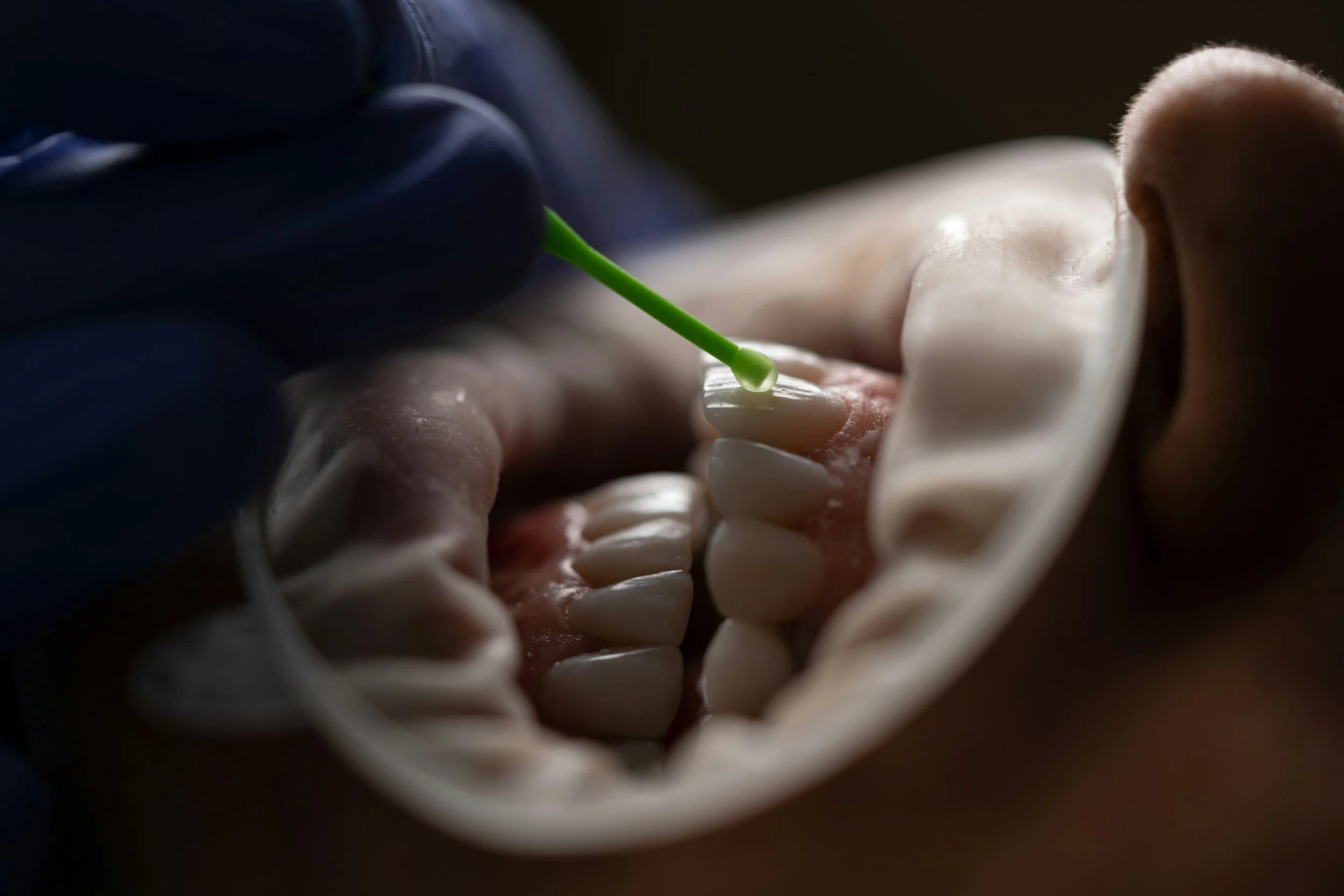 Dentist Manchester | Family Dentist in Whitefield - Whitefield Dental