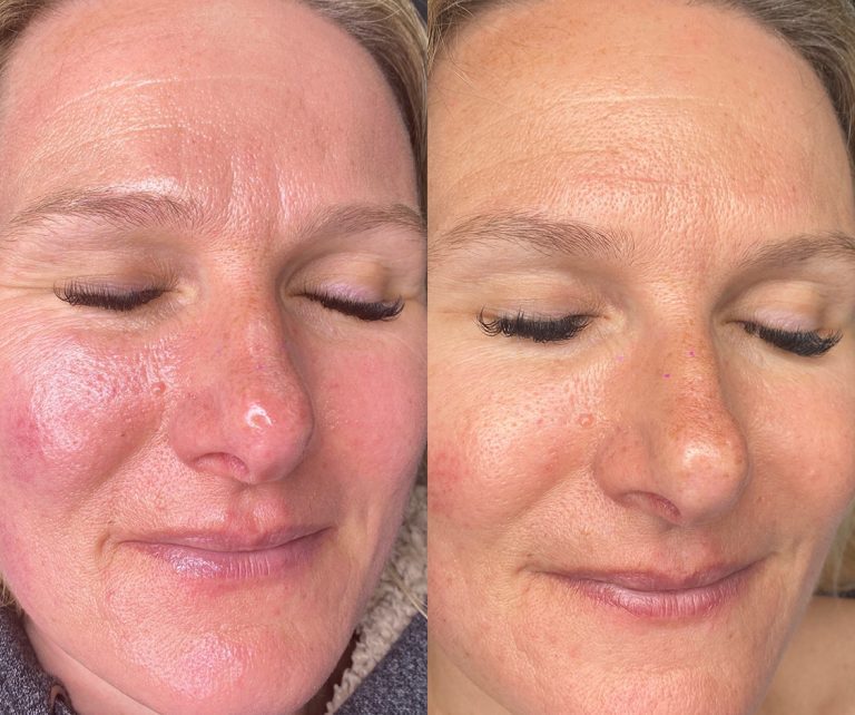 Norwich Face & Body Clinic | Skin, face & body treatments