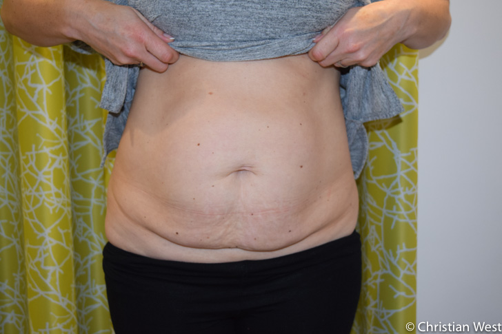 Plastic Surgeon Manchester | Christian West