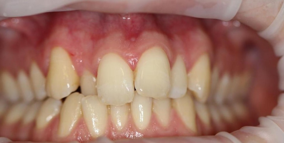 Private Dentist Folkestone Kent | Smile Arch Dental