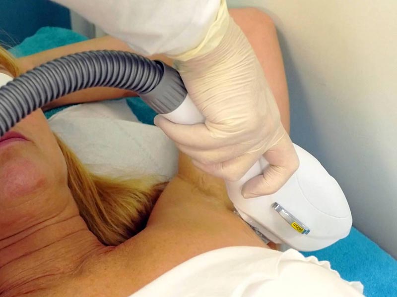 Tattoo removal Bognor Regis | Laser hair removal Bognor Regis